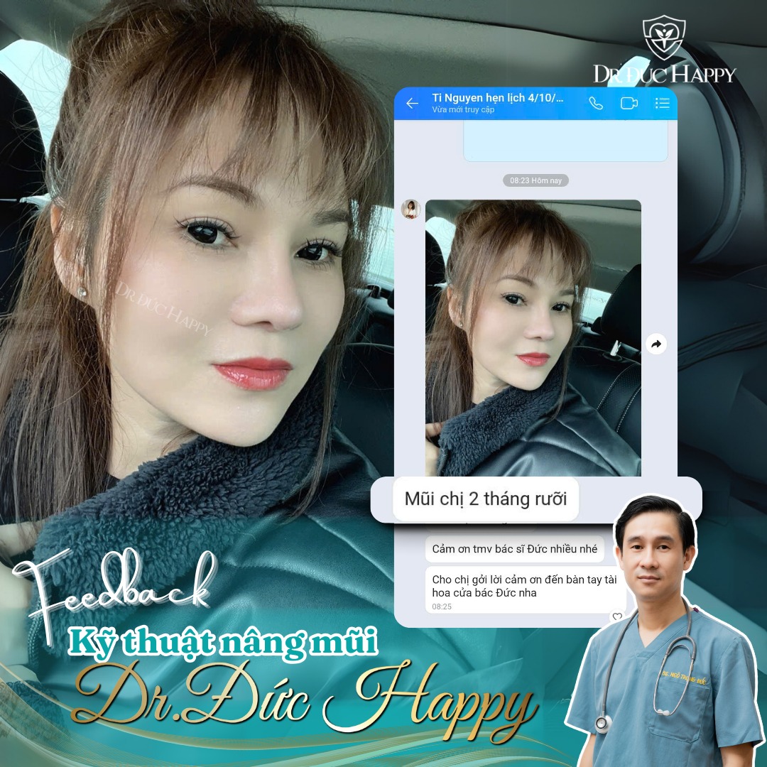 bác sĩ nâng mũi giỏi