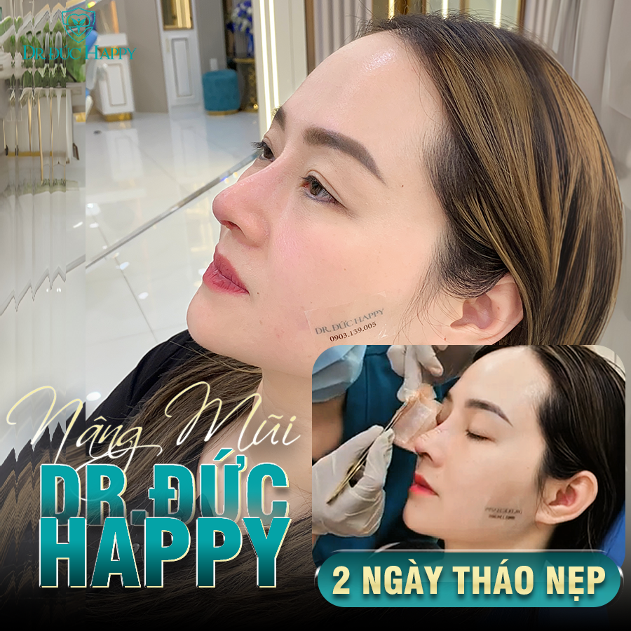 bác sĩ nâng mũi giỏi