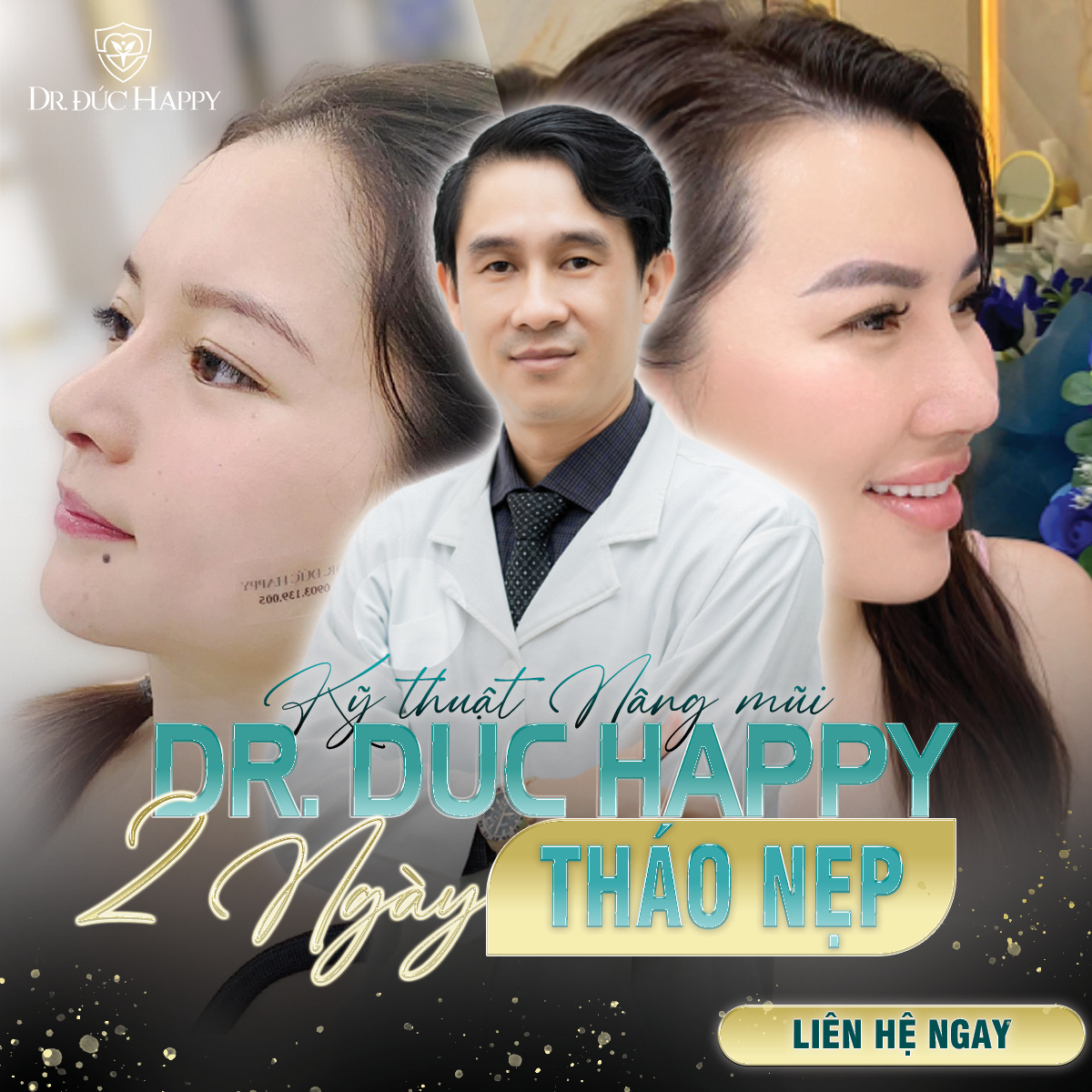 bác sĩ nâng mũi giỏi