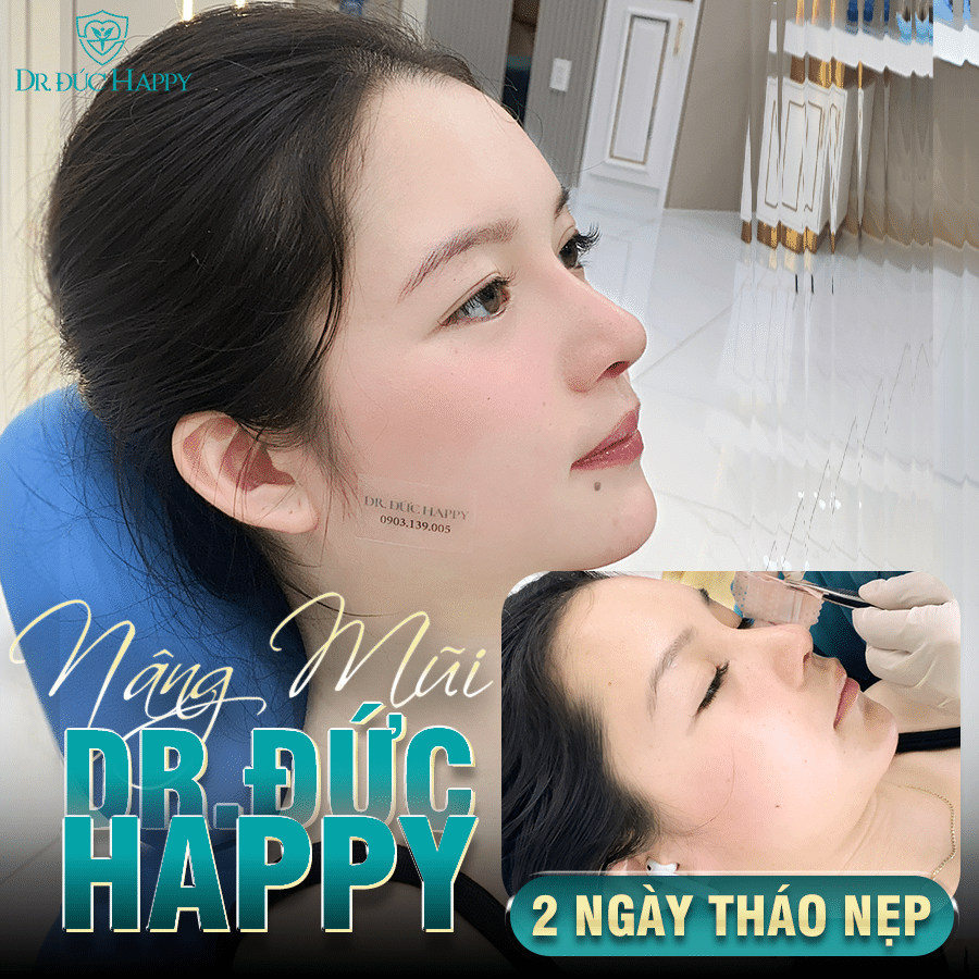 bác sĩ nâng mũi giỏi