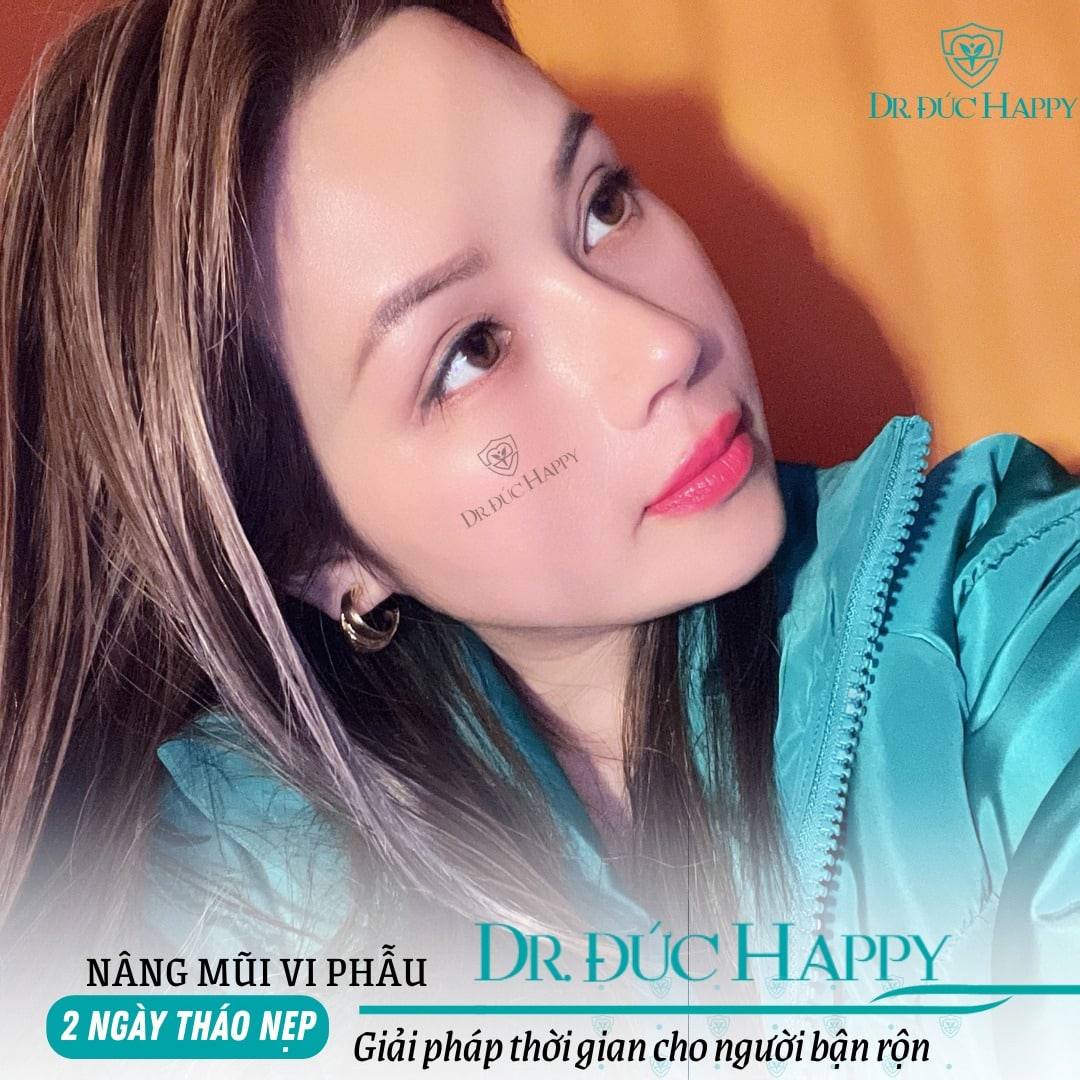 bác sĩ sửa mũi uy tín