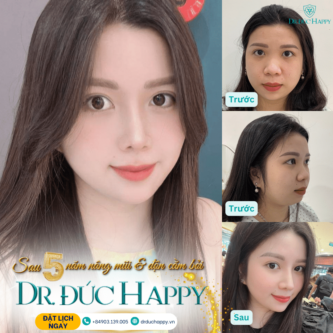 bác sĩ sửa mũi uy tín