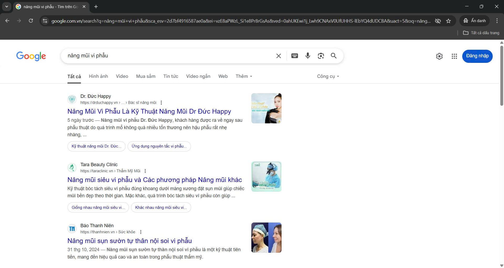 Dịch vụ SEO số 1