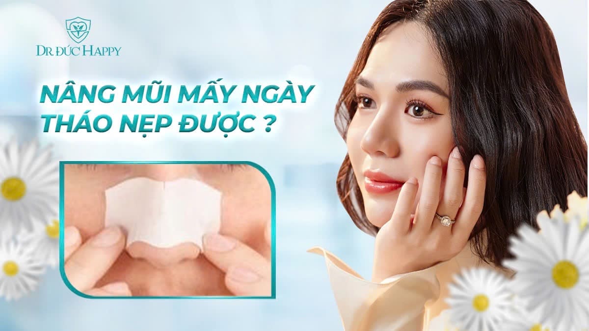 nâng mũi mấy ngày tháo nẹp
