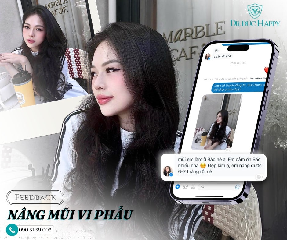 nâng mũi vi phẫu