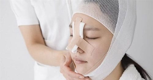 sửa mũi sụn sườn hỏng