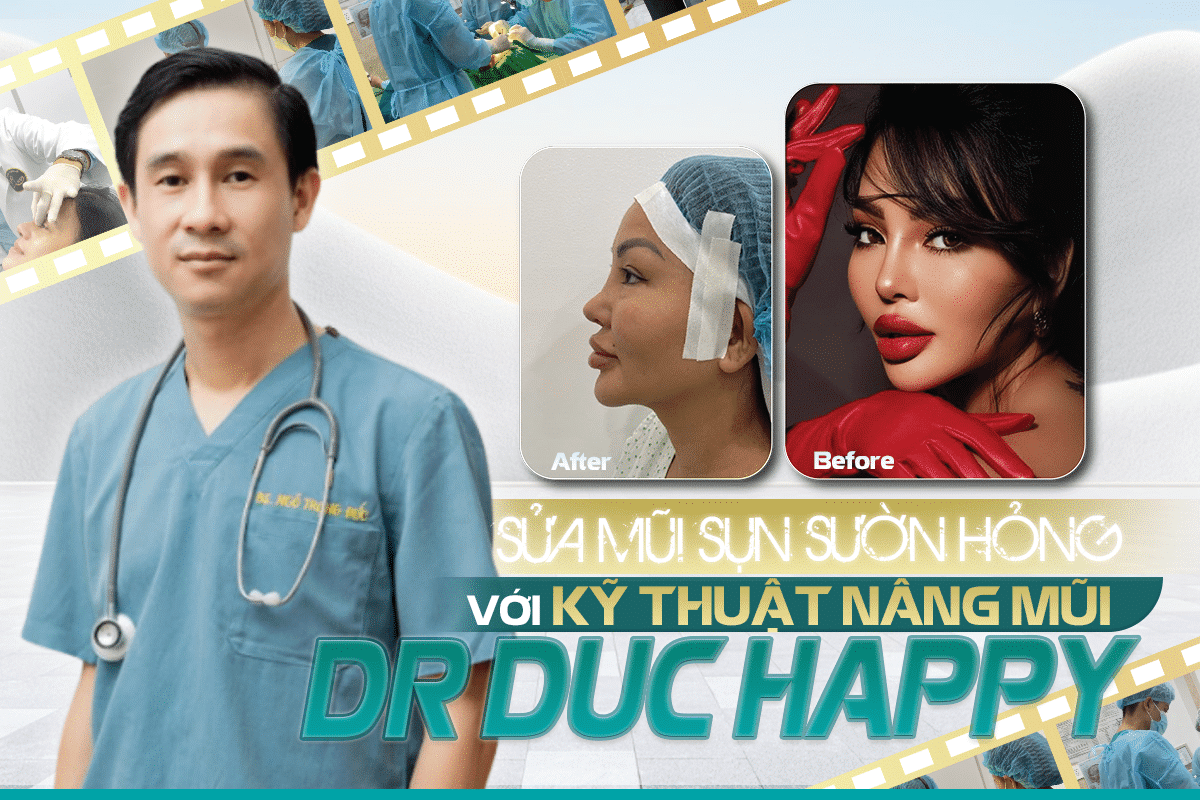 bác sĩ nâng mũi giỏi
