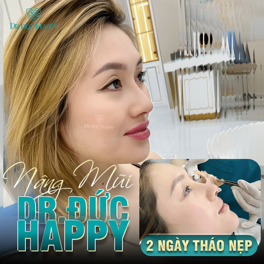 bác sĩ nâng mũi giỏi